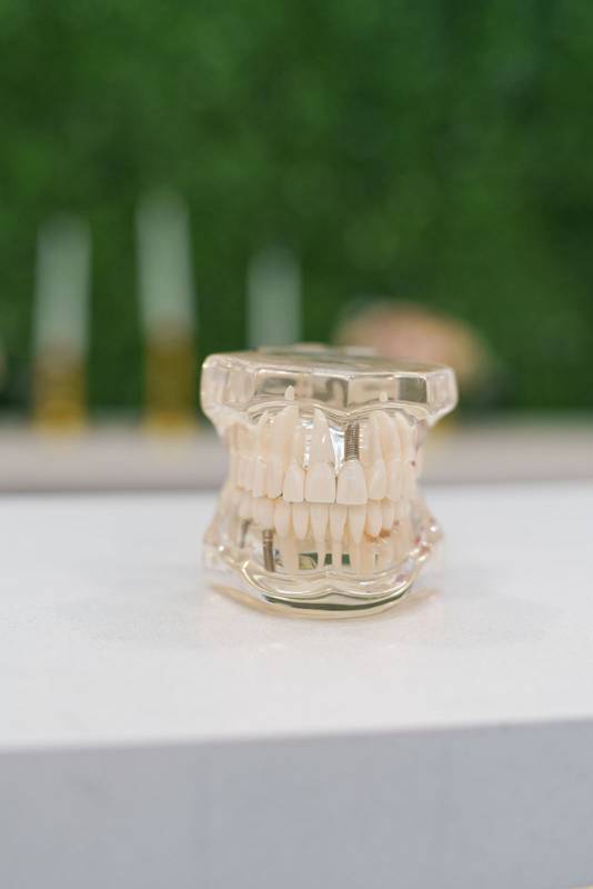 glass denture, didactic article, details of teeth, molars, gums